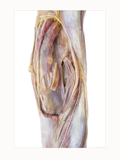 Lower Limb, Posterior View Product Thumbnail